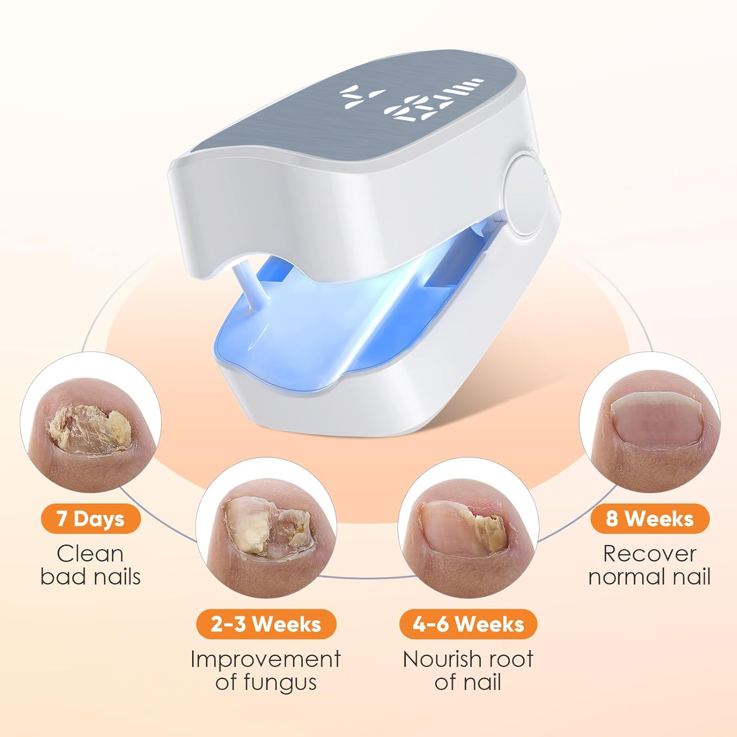 1 pçs eficaz recarregável remo - Industrial Laser Removal avaliação e preço