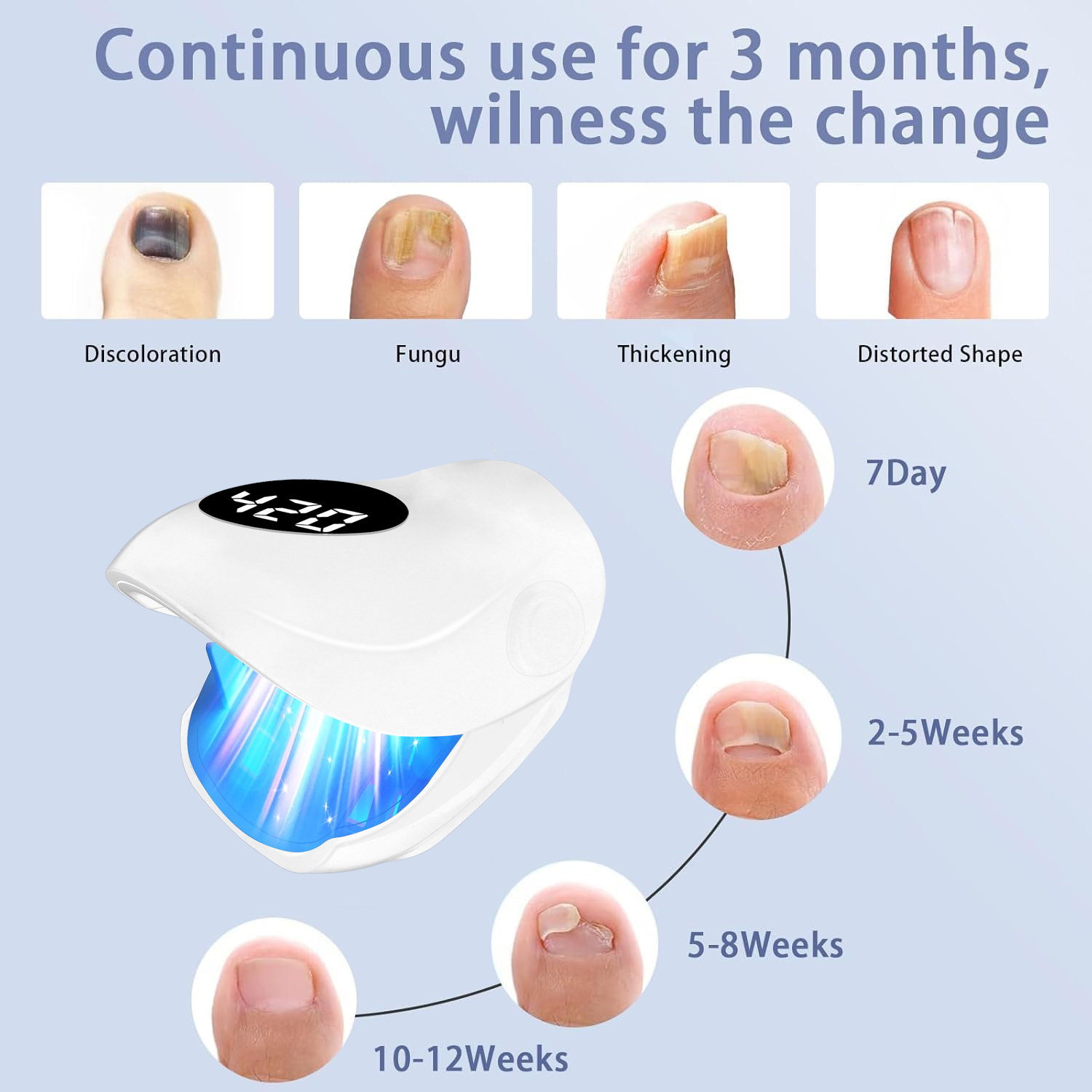 Lâmpada de Fototerapia a Laser - Industrial Laser Removal avaliação e preço